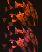 Anti-Calpain 1 Antibody, clone 10E6O5, Rabbit Monoclonal