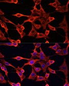 Anti-TYMS antibody produced in rabbit