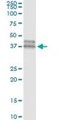 ANTI-OLIG2 antibody produced in mouse clone 2A8, purified immunoglobulin, buffered aqueous solution