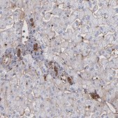 Anti-ACTN4 antibody produced in rabbit Prestige Antibodies® Powered by Atlas Antibodies, affinity isolated antibody, buffered aqueous glycerol solution