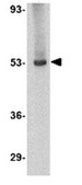 Anti-TSLP receptor Antibody from rabbit, purified by affinity chromatography