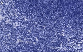 Anti-JAK2 Antibody, clone 1L13 ZooMAb® Rabbit Monoclonal recombinant, expressed in HEK 293 cells