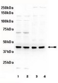 Anti-phospho-MEK1 (Thr292) Antibody Upstate®, from rabbit