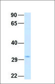 Anti-SDHB antibody produced in rabbit affinity isolated antibody