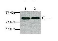Anti-GCLM antibody produced in rabbit affinity isolated antibody
