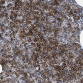 Anti-KCNJ5 antibody produced in rabbit Prestige Antibodies® Powered by Atlas Antibodies, affinity isolated antibody, buffered aqueous glycerol solution