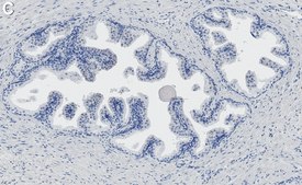 Anti-PSA Antibody, clone 1E10 ZooMAb® Rabbit Monoclonal recombinant, expressed in HEK 293 cells