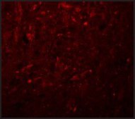 Anti-TRESK antibody produced in rabbit affinity isolated antibody, buffered aqueous solution