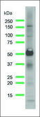 Anti-CD25 antibody, Rabbit monoclonal recombinant, expressed in proprietary host, clone SP176, affinity isolated antibody