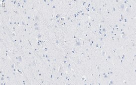 Anti-TPH-1 Antibody, clone 3J7 ZooMAb® Rabbit Monoclonal recombinant, expressed in HEK 293 cells