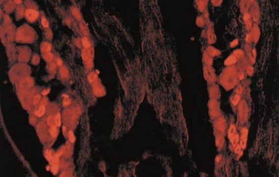 Anti-Capsaicin Receptor Antibody, CT Chemicon®, from rabbit