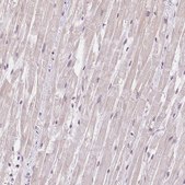 Anti-TNNT3 antibody produced in rabbit Prestige Antibodies® Powered by Atlas Antibodies, affinity isolated antibody, buffered aqueous glycerol solution