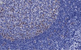Anti-Cdk2 Antibody, clone 1B21 ZooMAb® Rabbit Monoclonal recombinant, expressed in HEK 293 cells