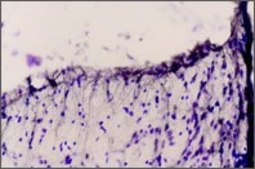 Anti-Endothelin Receptor B antibody produced in rabbit affinity isolated antibody, lyophilized powder