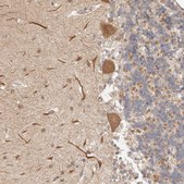 Anti-AFDN antibody produced in rabbit Prestige Antibodies® Powered by Atlas Antibodies, affinity isolated antibody, buffered aqueous glycerol solution, ab2