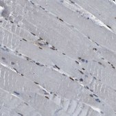 Anti-SRPK2 antibody produced in rabbit Prestige Antibodies® Powered by Atlas Antibodies, affinity isolated antibody, buffered aqueous glycerol solution