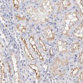 Anti-ABCB1 antibody produced in rabbit Prestige Antibodies® Powered by Atlas Antibodies, affinity isolated antibody, buffered aqueous glycerol solution