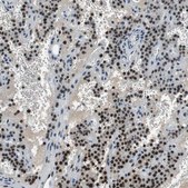 抗-MAFB 兔抗 Prestige Antibodies® Powered by Atlas Antibodies, affinity isolated antibody, buffered aqueous glycerol solution