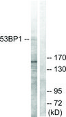 Anti-53BP1 antibody produced in rabbit affinity isolated antibody