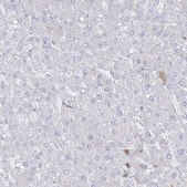 Anti-HYAL2 antibody produced in rabbit Prestige Antibodies® Powered by Atlas Antibodies, affinity isolated antibody, buffered aqueous glycerol solution