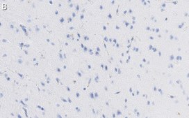 Anti-GAD67 Antibody, clone 1G10.2 ZooMAb® Mouse Monoclonal recombinant, expressed in HEK 293 cells