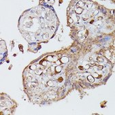 Anti-AGT antibody produced in rabbit