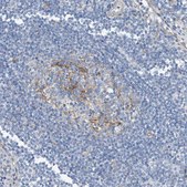Anti-TNS2 antibody produced in rabbit Prestige Antibodies® Powered by Atlas Antibodies, affinity isolated antibody, buffered aqueous glycerol solution