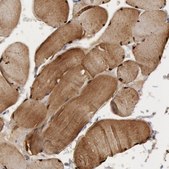 Anti-FHL1 antibody produced in rabbit Prestige Antibodies® Powered by Atlas Antibodies, affinity isolated antibody, buffered aqueous glycerol solution, Ab2