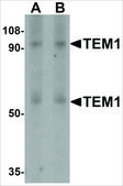 Anti-TEM1 (ab1) antibody produced in rabbit affinity isolated antibody, buffered aqueous solution