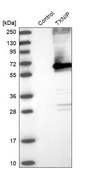 Anti-TXNIP antibody produced in rabbit Prestige Antibodies® Powered by Atlas Antibodies, affinity isolated antibody, buffered aqueous glycerol solution