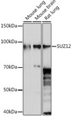 Anti-SUZ12 Antibody, clone 1M3V2, Rabbit Monoclonal