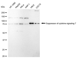 Anti Suppressor Of Cytokine Signaling 7 Antibody, clone 24GB1820, Rabbit Monoclonal clone 24GB1820, recombinant rabbit monoclonal, expressed in HEK293 cells