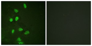抗-CHOP，N端子 兔抗 affinity isolated antibody