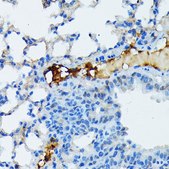 Anti-Fibrinogen alpha chain (FGA) antibody produced in rabbit