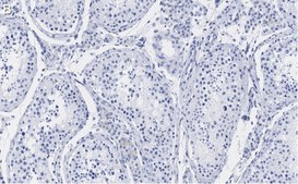 Anti-FMR1 (C-terminal) Antibody, clone 2B16 ZooMAb® Rabbit Monoclonal recombinant, expressed in HEK 293 cells