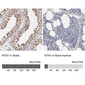 Anti-KTN1 antibody produced in rabbit Prestige Antibodies® Powered by Atlas Antibodies, affinity isolated antibody, buffered aqueous glycerol solution