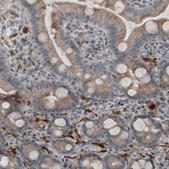Monoclonal Anti-UCHL1 antibody produced in mouse Prestige Antibodies® Powered by Atlas Antibodies, clone CL3210, purified immunoglobulin, buffered aqueous glycerol solution
