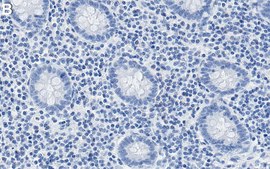 Anti-CTLA4/CD152 Antibody, clone 1D10 ZooMAb® Rabbit Monoclonal recombinant, expressed in HEK 293 cells