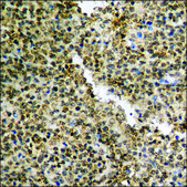 Anti-phospho-STAT3 (pTyr705) antibody produced in rabbit affinity isolated antibody