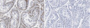 Anti-FMR1 (C-terminal) Antibody, clone 2B16 ZooMAb® Rabbit Monoclonal recombinant, expressed in HEK 293 cells