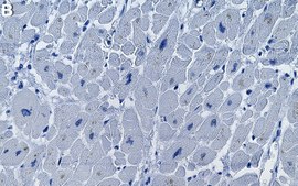 Anti-OXCT1 Antibody, clone 1B11 ZooMAb® Rabbit Monoclonal recombinant, expressed in HEK 293 cells