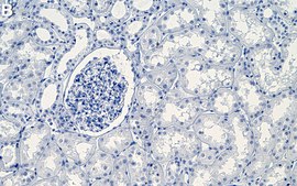 Anti-THSD7A Antibody, clone 2F15-L1 ZooMAb® Rabbit Monoclonal recombinant, expressed in HEK 293 cells