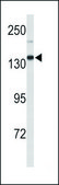 ANTI-XDH (N-TERM) antibody produced in rabbit IgG fraction of antiserum, buffered aqueous solution