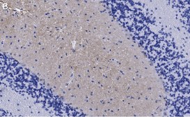 Anti-GluR1 Antibody, clone 1C11, ZooMAb® Rabbit Monoclonal recombinant, expressed in HEK 293 cells