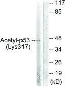 抗乙酰基 (Lys 319) p53 抗体，C 端 兔抗 affinity isolated antibody