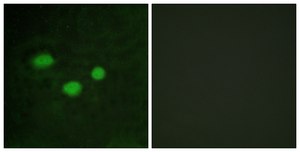 Anti-DNMT3B antibody produced in rabbit affinity isolated antibody
