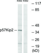 Anti-p57 KIP2 antibody produced in rabbit affinity isolated antibody