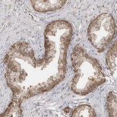Anti-YWHAG antibody produced in rabbit Prestige Antibodies® Powered by Atlas Antibodies, affinity isolated antibody, buffered aqueous glycerol solution