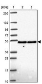 Anti-DDX39B antibody produced in rabbit Prestige Antibodies® Powered by Atlas Antibodies, affinity isolated antibody, buffered aqueous glycerol solution