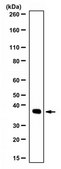 Anti-GAPDH Antibody from rabbit, purified by affinity chromatography